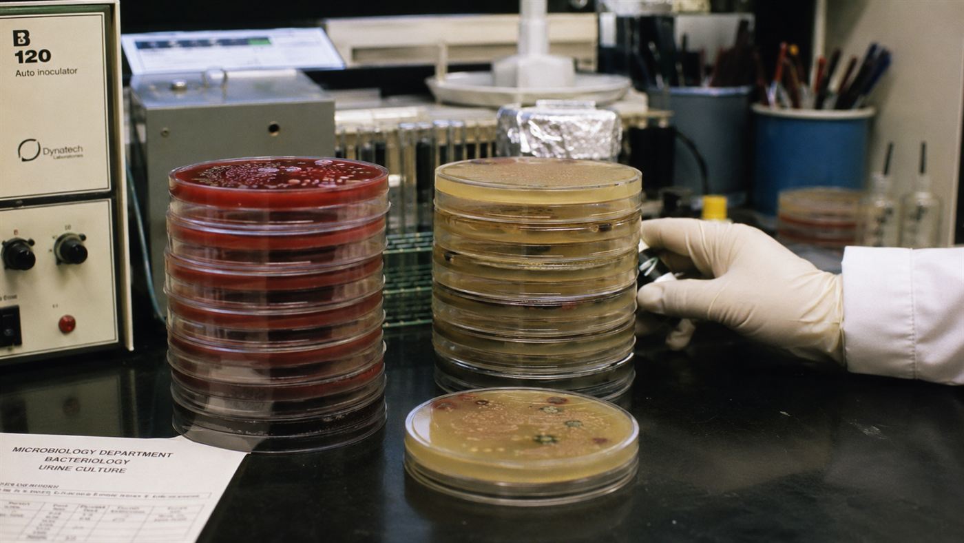 A stack of petri dishes growing bacterial cultures on a 1980s hospital microbiology lab bench
