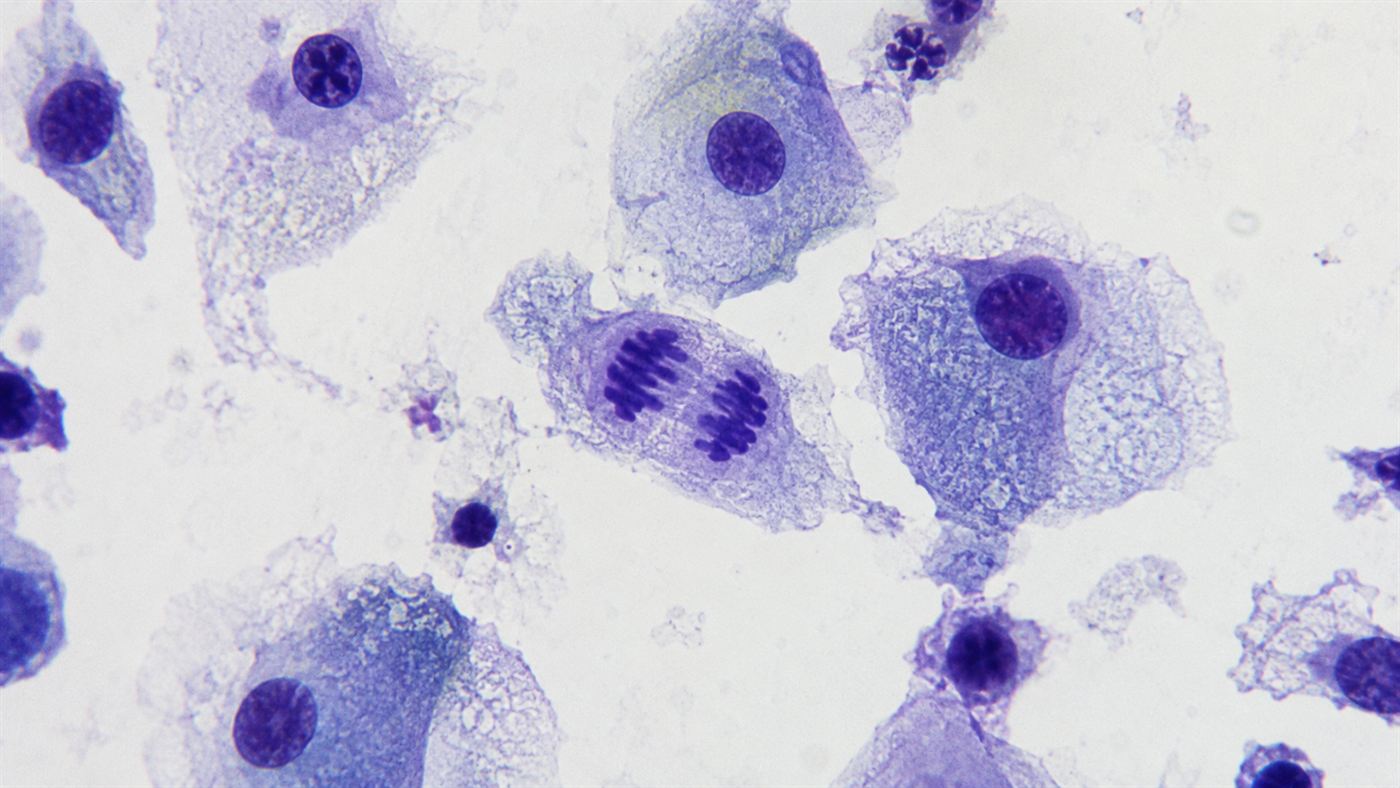 HeLa cells dividing under a microscope, stained blue and purple, the immortal cells of Henrietta Lacks