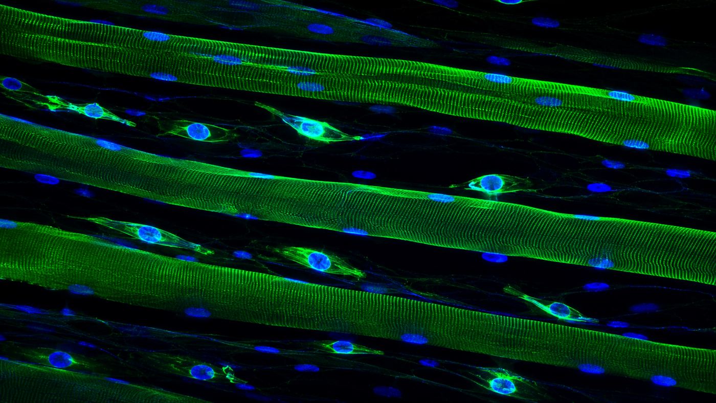 A microscope view of muscle stem cells and muscle fibres glowing in fluorescent blue and green