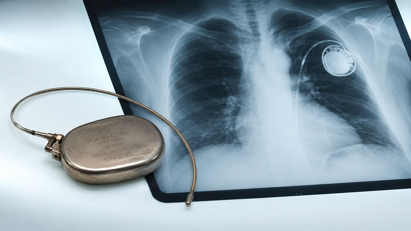 A 1970s nuclear pacemaker device beside a chest X-ray showing an implanted pacemaker