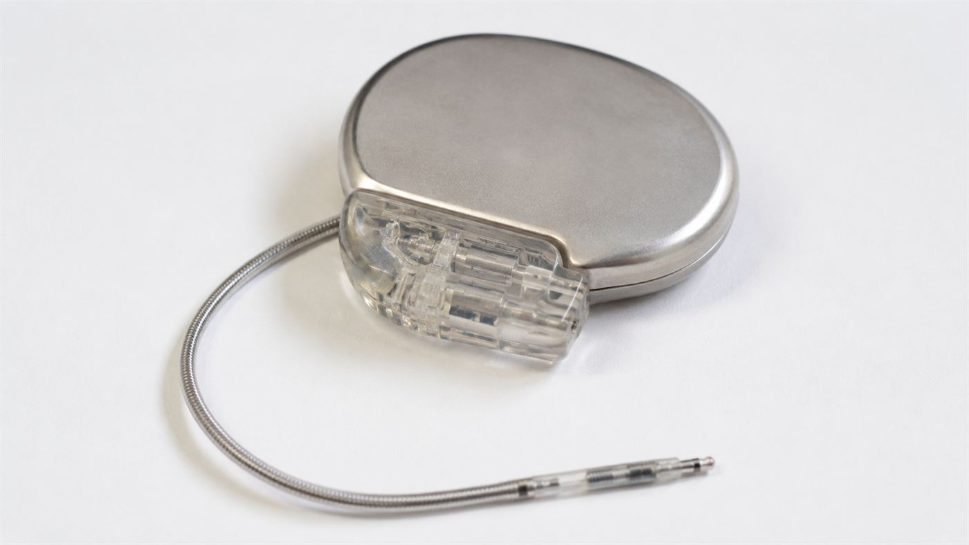 A medical pacemaker implant, one possible use for a long-lasting diamond battery
